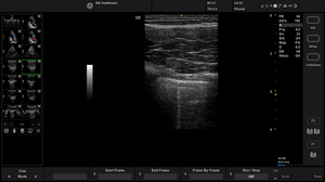 active-l612-lung_1.jpg