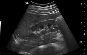 thumb-renal-1.jpeg