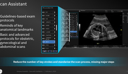 Scan Assistant